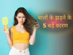 बाल झड़ने और गंजेपन का कारण हैं ये 5 स्वास्थ्य समस्याएं, समय पर इलाज न मिलने पर खोपड़ी हो जाती है चिकनी बाल झड़ने और गंजेपन का कारण हैं ये 5 स्वास्थ्य समस्याएं, समय पर इलाज न मिलने पर खोपड़ी हो जाती है चिकनी