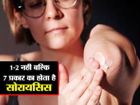 15 से 25 की उम्र में सोरायसिस का खतरा होता है सबसे ज्यादा, जानें सोरायसिस की शुरुआती स्टेज के बारे में