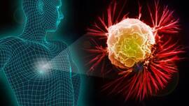 Male Breast Cancer: Bloody Discharge From Nipple And Other Unusual Symptoms You Should Never Ignore