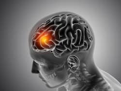 सामान्य स्ट्रोक से ज्यादा घातक है साइलेंट स्ट्रोक, अटैक आने पर बंद हो जाती है मस्तिष्क में खून की आपूर्ति, जानिए बचाव