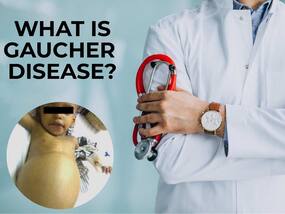 Gaucher Disorder: Understanding The Lysosomal Disorder Down The Family Tree