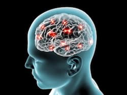 National Epilepsy Day : राष्ट्रीय मिर्गी दिवस पर जानें कैसे करें मिर्गी रोगियों की देखभाल और उपचार