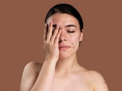 इन 6 तरीकों से PCOS के दौरान होने वाली त्वचा की समस्याओं से पाएं छुटकारा, पिगमेंटेशन और अनचाहे बालों से मिलेगी निजात