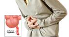 Antibiotics Or Surgery For Appendicitis: Which Could Be A Better Treatment Option For You?