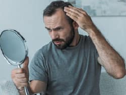 Baldness cure: क्या गंजेपन का हो सकेगा पक्का इलाज? वैज्ञानिकों ने खोज निकाला ये खास तरीका