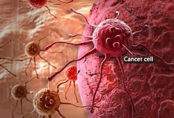 6 Most Common Cancers In Men And How to Recognise Their Symptoms - Doctor Explains