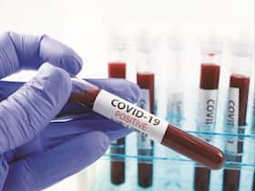 India Records 7,584 New Cases In The Last 24 Hours