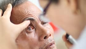 Black Fungus After Dengue: अब डेंगू के बाद ब्लैक फंगस होने का मामला आया सामने, ग्रेटर नोएडा के मरीज में दिखे गम्भीर लक्षण