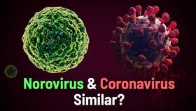 Is Norovirus Infection A Severe Threat To People? Know Reason Behind It's Spread And Precautionary Measures To Follow | Watch Video