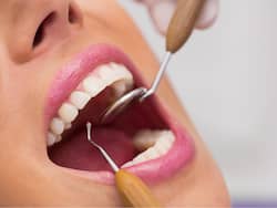 Poor Oral Health Is Worse Than You Think; It Could Elevate The Risk Of COVID-19