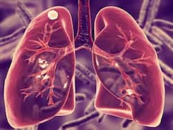 Importance of testing to improve pneumonia prognosis
