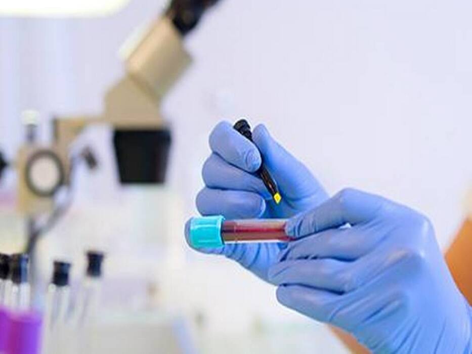 Pfizer's COVID-19 Pills Paxlovid Gets Nod From FDA: Possible Side Effects And Other Details of This Oral Antiviral Drug