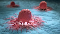 Targeting Cancer With Immune Cells: A Changing Paradigm In Anti-Cancer Therapy