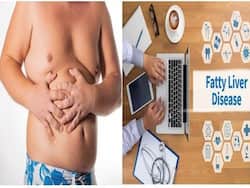 फैटी लिवर डिजीज से हैं ग्रस्त, तो भूलकर भी ना खाएं ये चीजें, समस्या कम नहीं बढ़ जाएगी दोगुनी