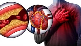 Breathlessness Post COVID-19 Recovery Is A Warning Signal of Heart Damage: Complications of This Condition
