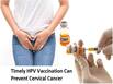 Most Cervical Cancers Are Caused By HPV Infections: Get Vaccinated to Protect Yourself And Others