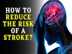 10 Tips to Avoid The Risk of Stroke Naturally