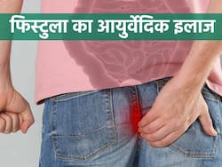 सर्जरी के बिना भी संभव है पुराने से पुराने फिस्‍टुला का इलाज, आयुर्वेदिक डॉक्टर ने बताई सस्‍ती और टिकाऊ तकनीक