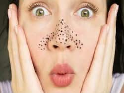 Home Remedies for Blackheads: ये 1 घरेलू उपाय नाक के ब्लैकहेड्स से दिलाएगा हमेशा के लिए छुटकारा, यूं करें इस्तेमाल