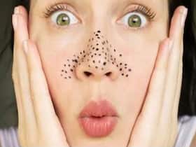 How Do You Get Rid Of Deep-Rooted Blackheads?