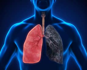 Causes Of Lung Damage: घर का गलीचा से लेकर कीटनाशक तक फेफड़ों को खराब कर सकती हैं ये 5 चीजें, जानकर नहीं करेंगे ये गलती