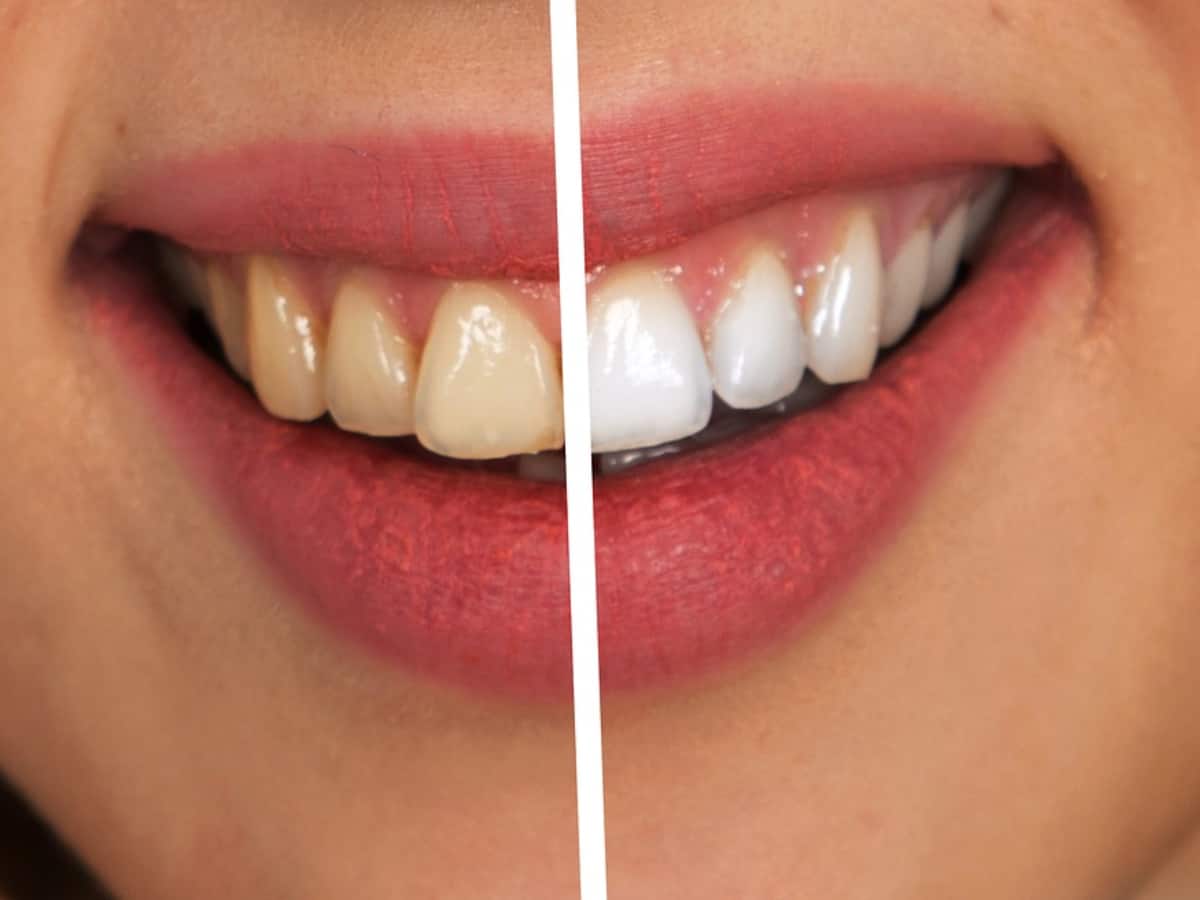 Beyond Oolong These Unique Ingredients Are Best To Make Your Teeth