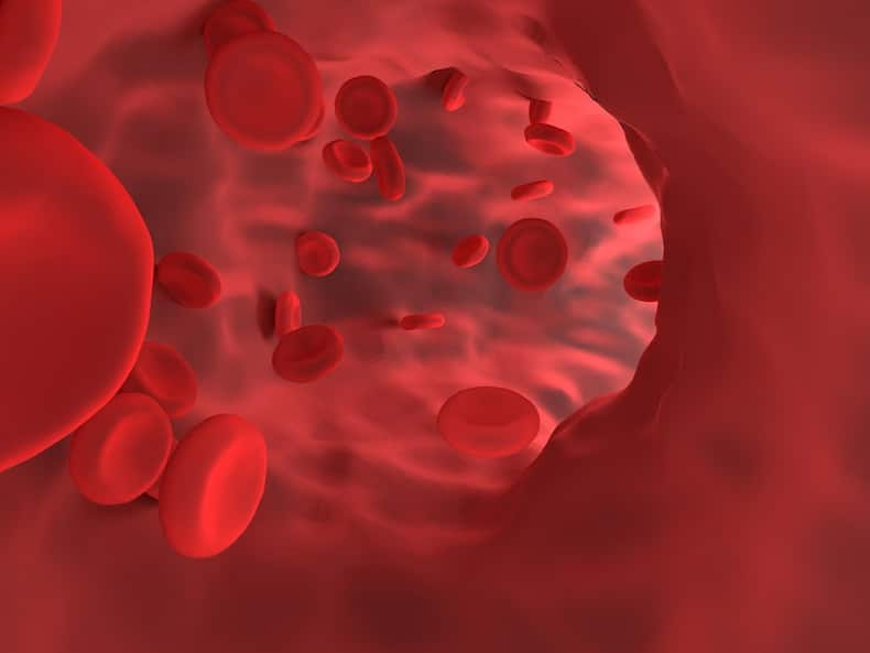 thalassemia