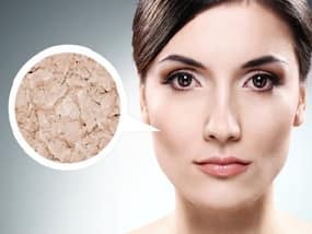 Skin Pigmentation Is A Common Problem In Winter: Exclusive Beauty Recipes To Counter This