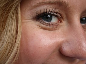Wrinkles Cropping Up On Your Face? Skincare Treatments For A Better-Looking Skin