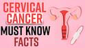 Cervical Cancer: क्या है सर्वाइकल कैंसर और क्या है इसका इलाज ? देखिये ये वीडियो