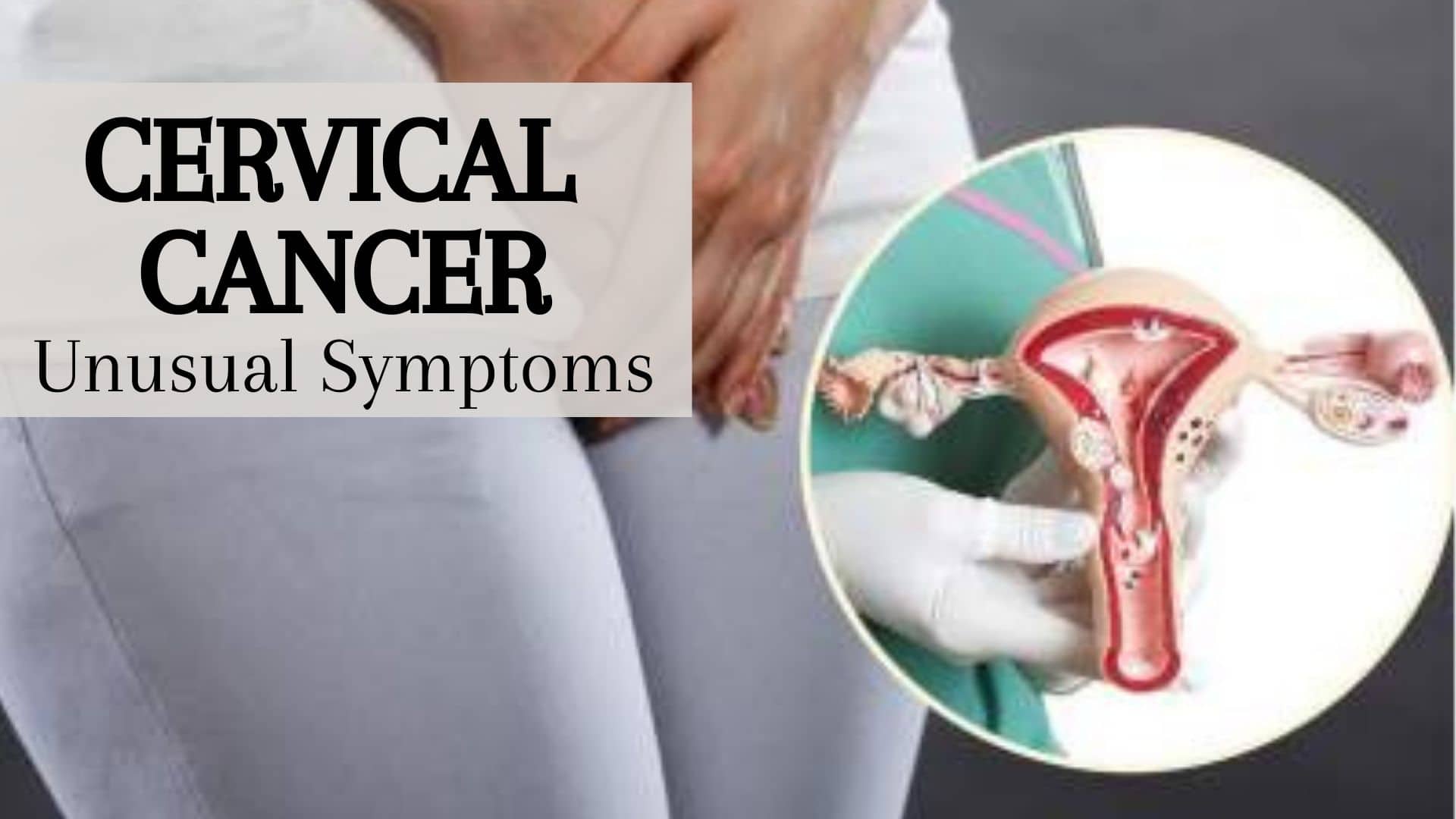 LeedsHealthAwareness on X: If you experience any potential symptoms of  #cervicalcancer e.g. vaginal bleeding that is unusual for you or changes to vaginal  discharge, speak to your GP. Symptoms are often caused