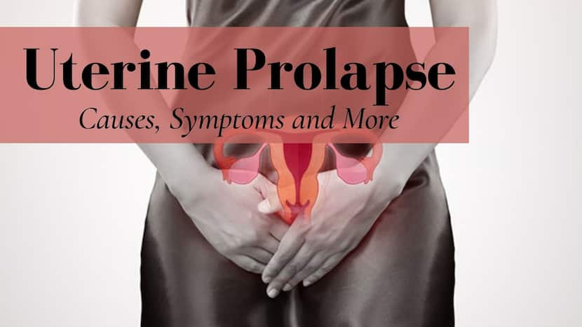 Uterine Prolapse Tissue Protruding From Vagina And Other Symptoms You