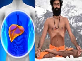 Exercise Can Prevent Fatty Liver Disease Caused By Overnutrition: How Yoga Can Help Here