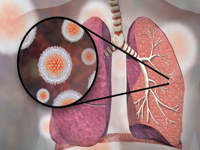 hepatitis