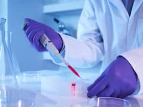 Expert Answers FAQs About Stem Cell Therapy Expert Answers FAQs About Stem Cell Therapy