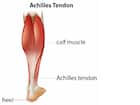 Achilles Tendon