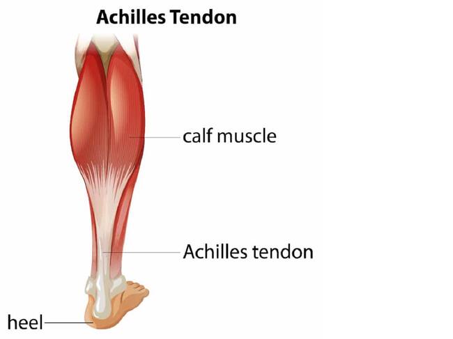achilles-tendon