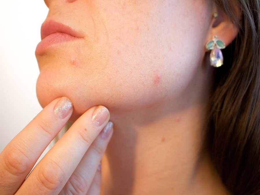 Does Vitamin B12 Deficiency Cause Skin Problems?