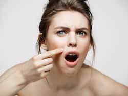 Acne In Winter: सर्दियों में मुंहासे निकलने के क्या हैं 4 बड़े कारण, विस्तार से जानिए डर्मेटोलॉजिस्ट की राय