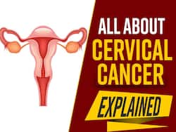 Cervical Cancer: Importance Of Shifting The Focus On Second Most Common Cancer In Women