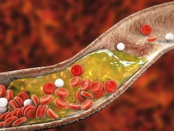 शरीर में गुड कोलेस्ट्रॉल बढ़ाने के लिए रोज करें ये 5 काम, कम हो जाएगा हार्ट अटैक का खतरा