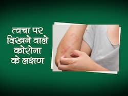 कोरोना के संकेत हो सकते हैं त्वचा पर दिखने वाले ये 5 रैशेस, जानिए इनकी पहचान कैसे करें