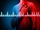 हार्ट अटैक (Heart Attack)