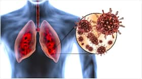 Recovered From COVID? Lung Abnormalities With Breathlessness Can Haunt You For Months, Warn Experts