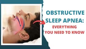 Obstructive Sleep Apnea: Everything You Need To Know Obstructive Sleep Apnea: Everything You Need To Know