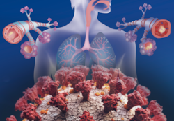 Suffering From Asthma? Doctor Shares Tips On How To Stay Safe From COVID-19