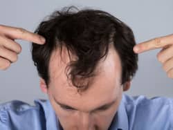 Hair fall рд╕реЗ рд╣реИрдВ рдкрд░реЗрд╢рд╛рди? рдЗрди 5 рдиреЗрдЪреБрд░рд▓ рддрд░реАрдХреЛрдВ рд╕реЗ рдЕрдкрдиреЗ рдХрдордЬреЛрд░ рдмрд╛рд▓реЛрдВ рдХреЛ рджреЗрдВ рдордЬрдмреВрддреА