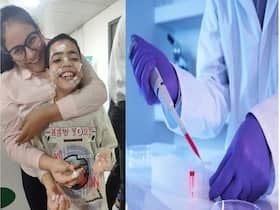 Cell-Based Therapy Proves Miraculous For This Boy With Sturge-Weber Syndrome     The Completely Blind Child Regains Vision