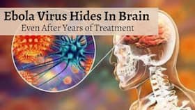 Ebola Virus Can Stay Hidden In Your Brain Even After 1 Year From Treatment: Study Reveals Shocking Facts