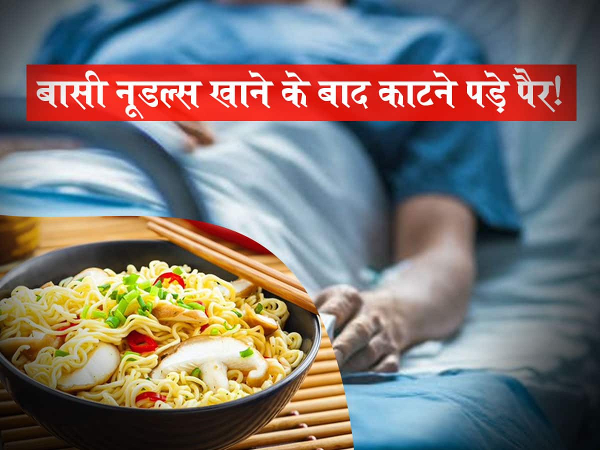 बासी नूडल्स खाने से अमेरिका में एक लड़के को गंवाने पड़े अपने दोनों पैर